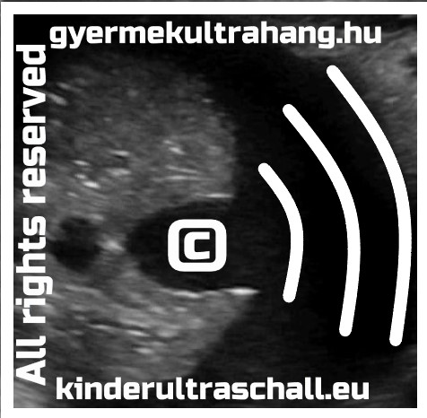 copyright